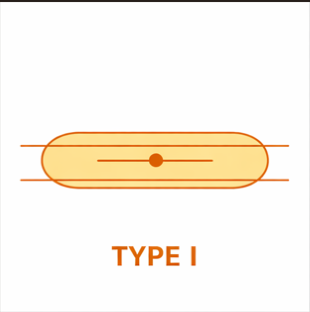 Type I light distribution
