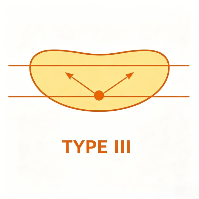 Type III light distribution
